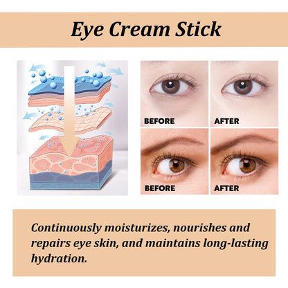 Snail Collagen Eye Cream Stick – Fade Wrinkles, Dark Circles & Puffiness